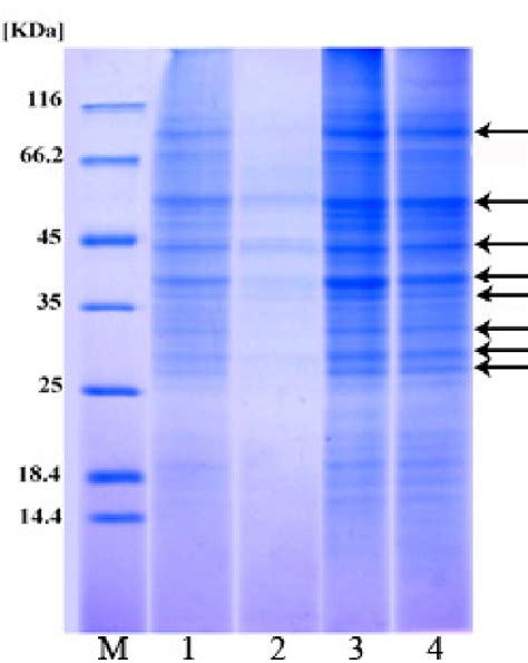 SDS PAGE Pattern Of Proteins During Secondary Somatic Embryogenesis In