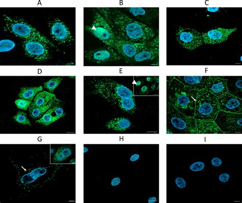 Immunolocalization Of Chemokine Receptors In Primary Endometrial