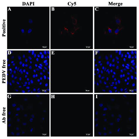 Cell Immunofluorescence Analysis Of Anti Pedv Antibody A C