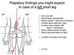 Fall 2013 Block III Short Leg Syndrome Flashcards Quizlet