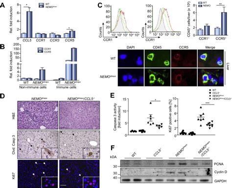 Ablation Of Ccl5 In Nemo Dhepa Livers Results In Reduced Liver Injury