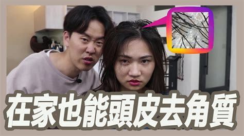 在家diy頭皮去角質的正確方法｜粘阿彬｜揚棄 Youtube