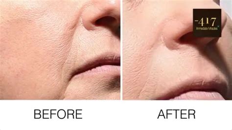 Minus 417 Miracle Immediate Wrinkle Filler Youtube