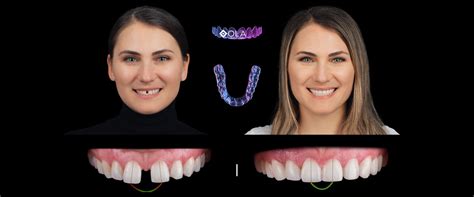 Centrul Stomatologic Dentus•Dentino Chisinau