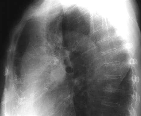 Chest Radiology