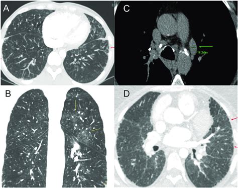 Multidetector Computed Tomography Patients And A Patient