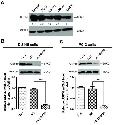 USP39 Expression In PCa Cell Lines And The Silencing Efficiency Of