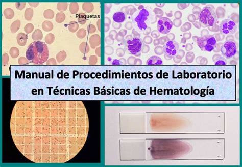 C Mo Leer Tu Hematolog A Completa Policl Nica Metropolitana