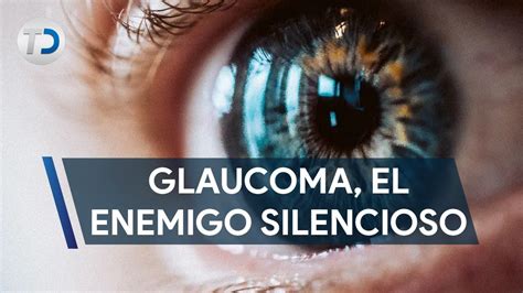 Glaucoma La Causa Más Común De Ceguera En El Mundo Youtube