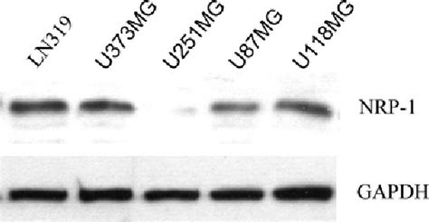 Figure From Rna Interference Targeting Nrp Inhibits Human Glioma