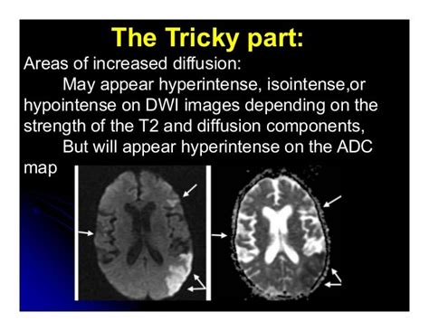 Dwi Adc Mri Principles In Veterinary Medicine