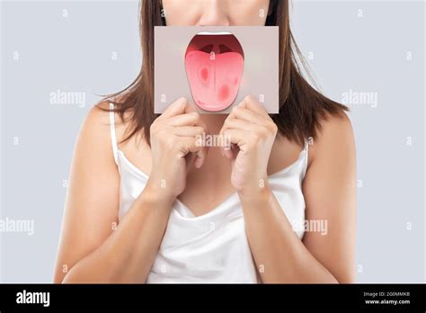 The Woman Show The Picture Of Tongue Problems Illustration Benign Migratory Glossitis On A