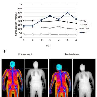 Body Composition And Serum Markers A The Values Of Insulin Like