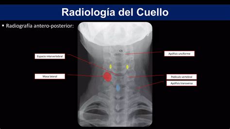 Anatom A De Columna Cervical Ppt