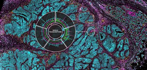 Single Cell Spatial Analysis Creates Covid Tissue Atlases