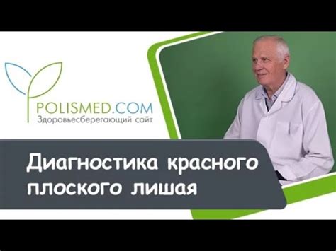 Диагностика красного плоского лишая - YouTube