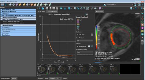 T2/T2 Analysis/T2* analysis - medisimaging