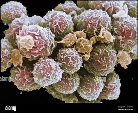 White Blood Cells Platelets Coloured Scanning Electron Micrograph