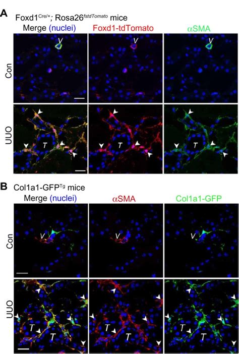 Renal Pericytes Are The Origin Of Scar Producing Myofibroblasts In Download Scientific Diagram