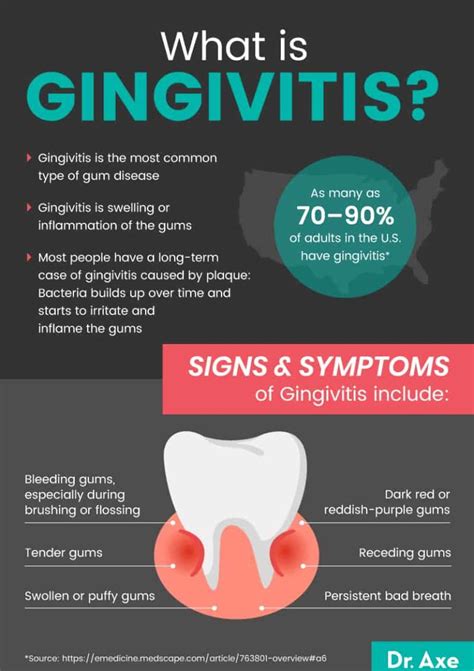 Gingivitis Symptoms and How to Get Rid of Gum Disease - Dr. Axe