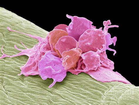 Activated Platelets Photograph By Steve Gschmeissnerscience Photo