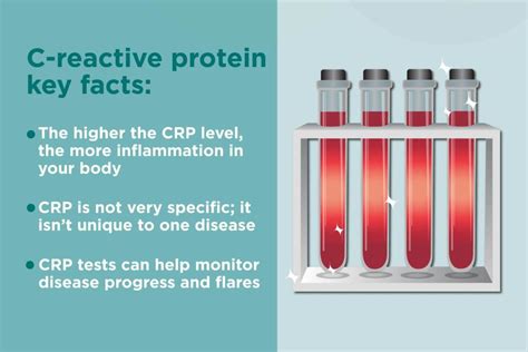 C Reactive Protein Test E Phlebotomy Training