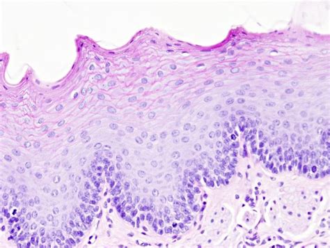 Epitelio plano estratificado queratinizado Histología Tejido