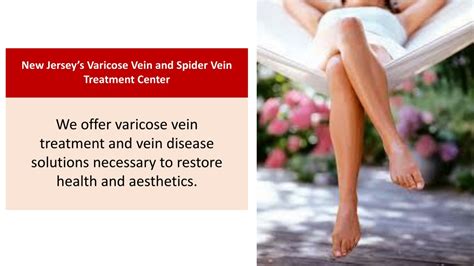 PPT New Jersey S Varicose Vein And Spider Vein Treatment Center