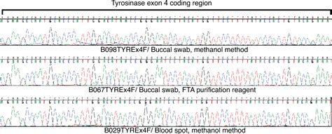 Dna Elution From Buccal Cells Stored On Whatman Fta Classic Cards Using