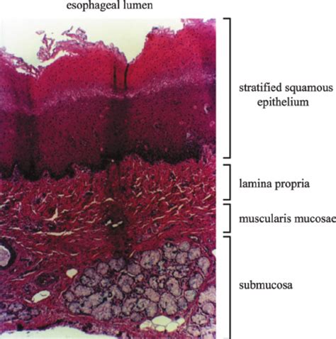 Photomicrograph Of A Cross Section Of The Esophageal Tissue Stained