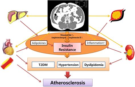 Ectopic Fat And Cardiometabolic And Vascular Risk International