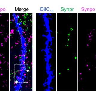 Workflow Of DiIC18 Staining Combined With Fluorescent Immunolabeling