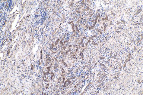 IHCeasy CASP7 Ready To Use IHC Kit KHC0406 Proteintech 武汉三鹰生物技术有限公司