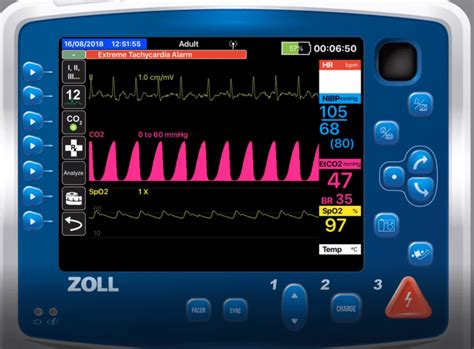 How To Use Capnography To Titrate Cpap Jems Ems Emergency Medical