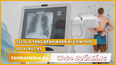 TamdaMedia CHÀO BUỔI SÁNG 28 2 2024 Séc gia tăng bệnh nhân bị