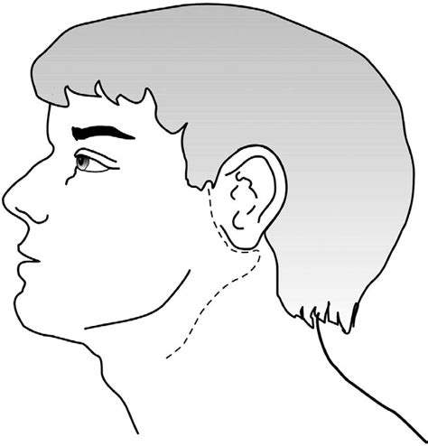 Figure From The Precision Of Four Commonly Used Surgical Landmarks