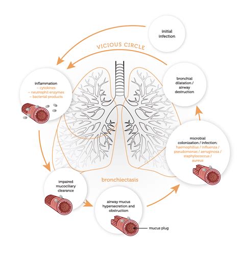 Physiology Vicious Cycle Panaceamk