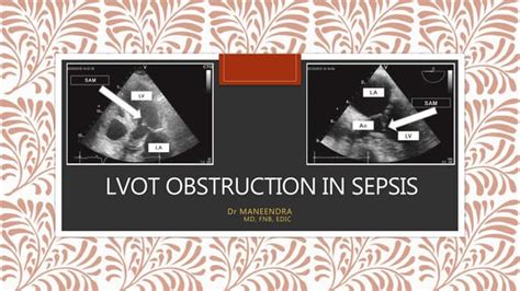 Lvot Obstruction In Icu Ppt