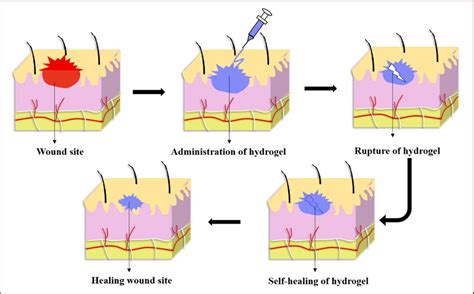 Application Of Self Healing Hydrogel In Wound Healing Download