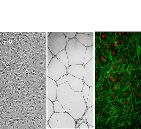 Human Dermal Microvascular Endothelial Cells CADMEC HMVEC 人真皮微血管內皮細胞