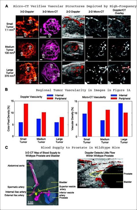 Functional Neoangiogenesis Imaging Of Genetically Engineered Mouse