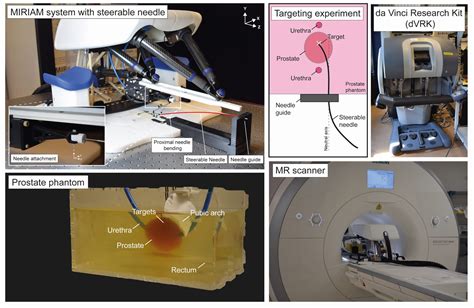 Mr Guided Hdr Prostate Brachytherapy With Teleoperated Steerable