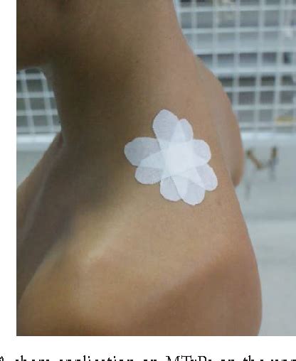 Figure 1 From Short Term Effects Of Kinesio Taping And Cross Taping