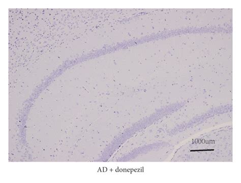 The results of Nissl staining. (a) Nissl staining in the AD + NS group ...