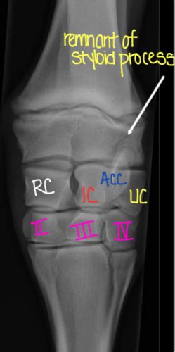 Equine Carpus Tarsus Flashcards Quizlet