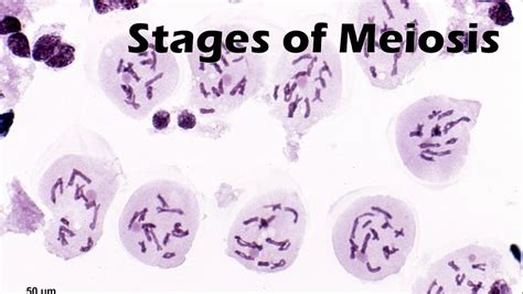 Prophase 1 Meiosis Microscope