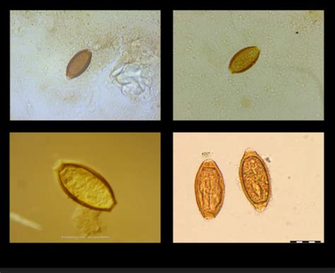 Trichuris Trichiura Flashcards Quizlet