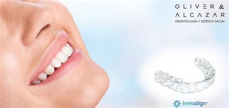 Tu Ortodoncia Invisible Con Invisalign Oliver Y Alcazar