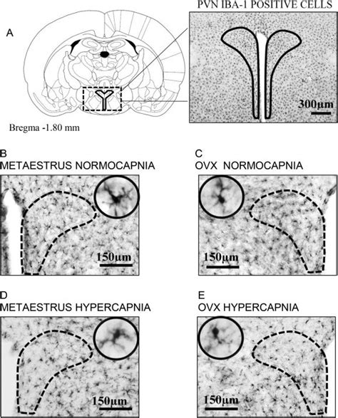 (A) Schematic representation of the paraventricular nucleus (PVN;... | Download Scientific Diagram