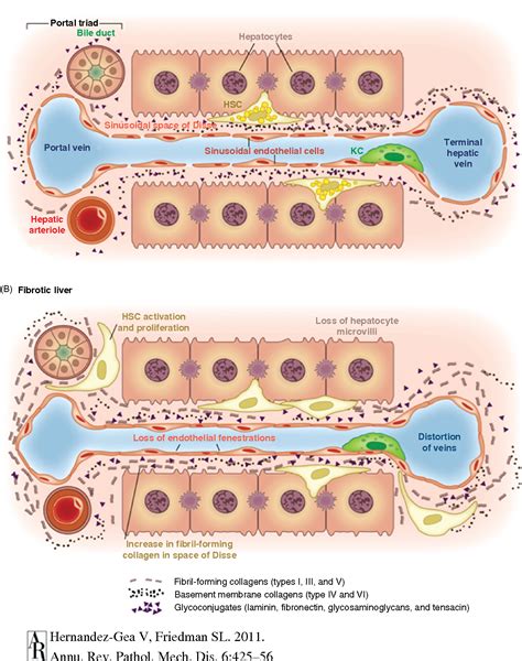 Figure 3 From Hepatic Stellate Cells And Liver Fibrosis Semantic Scholar